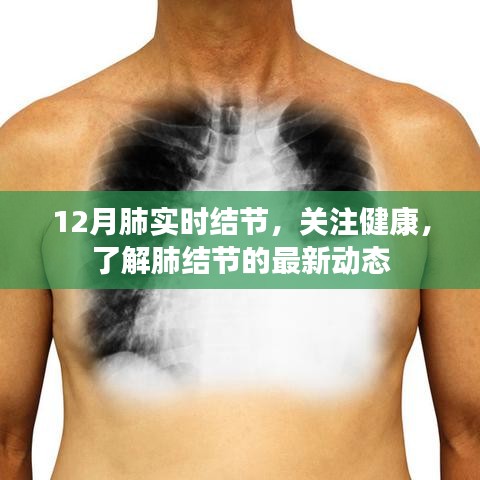關(guān)注健康，12月肺實時結(jié)節(jié)最新動態(tài)解讀
