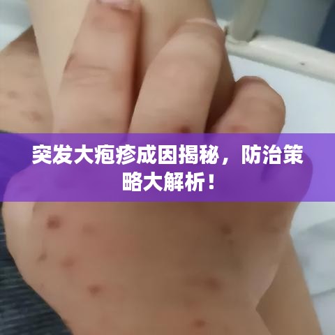 突發(fā)大皰疹成因揭秘，防治策略大解析！
