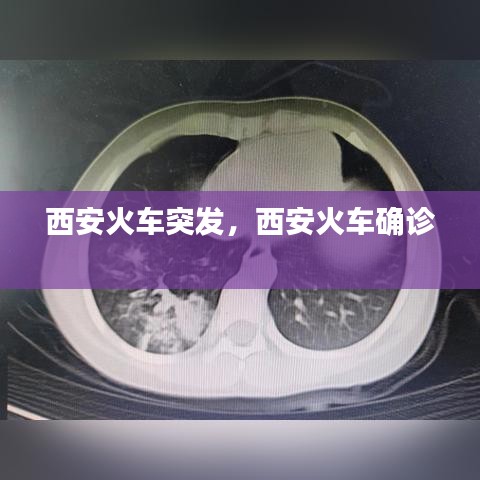 西安火車突發(fā)，西安火車確診