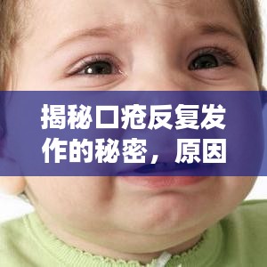 揭秘口瘡反復(fù)發(fā)作的秘密，原因何在？