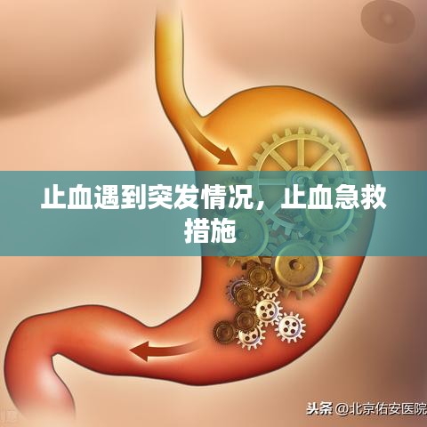 止血遇到突發(fā)情況，止血急救措施 