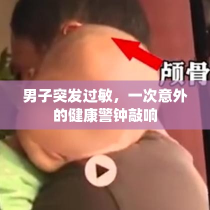 男子突發(fā)過敏，一次意外的健康警鐘敲響