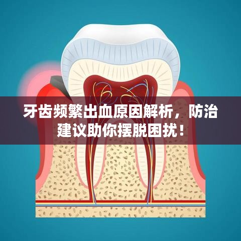 牙齒頻繁出血原因解析，防治建議助你擺脫困擾！