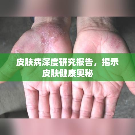 皮膚病深度研究報(bào)告，揭示皮膚健康奧秘